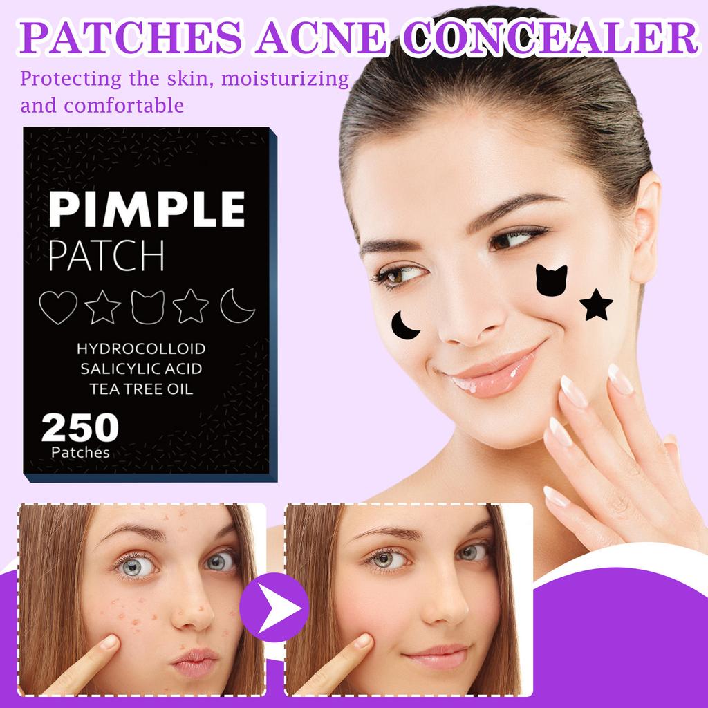 250 Acne Patches Acne Concealer To Fade Acne Patches