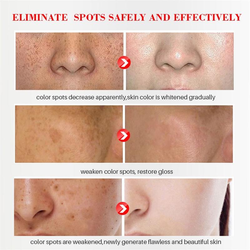 Sérum Blanchissant Anti-Taches Pigmentaires Correcteur de Mélanine Visage Taches de Rousseur Éclaircissant Beauté Soin de la Peau Coréen Jour Nuit