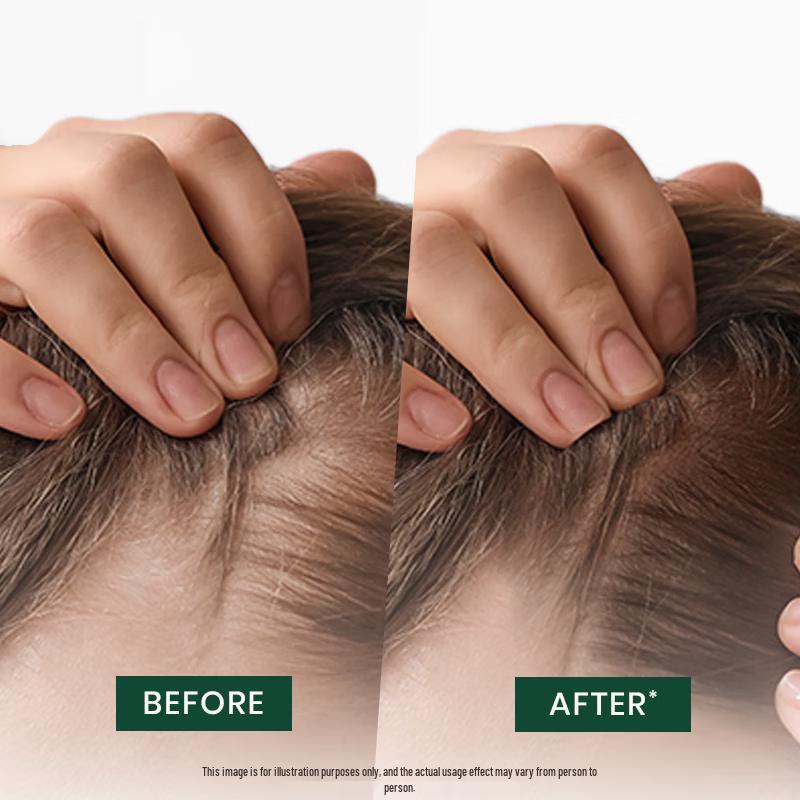 René Furterer Triphasic Progressive Anti-Hair Loss Serum