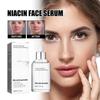 Freckles Removal Serum, Serum For Face And Body, Freckles Removal, Hydrating And Moisturizing Facial For All Type Skin 50ML