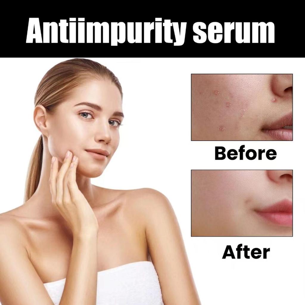 5ML/15ML/30ML/50ML/TRSTAY rezolvă problemele pielii și vă menține fața blocată în apă fără probleme, menținând-o umedă