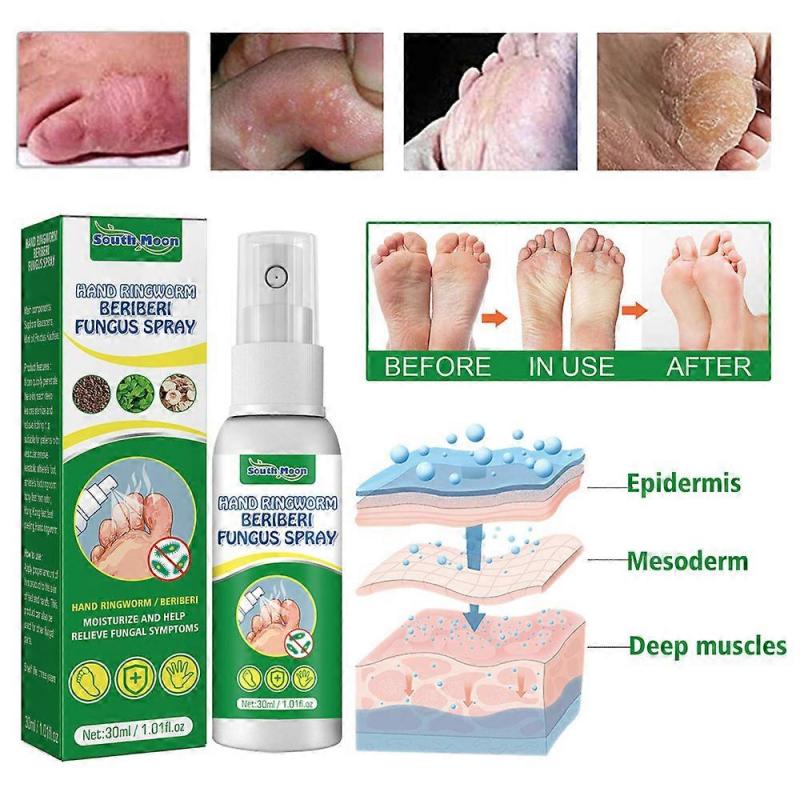 Athletes Foot Spray,Athletes Foot Treatment Spray,Foot Fungal Treatment,Athletes Foot Remedies,Effective Foot Odour Spray
