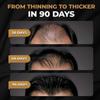SPARTAN Root Activator Shampoo for Men - Anti-Hair Loss Shampoo, Stimulates Hair Growth, Strengthens Thin Hair (1 Pack Available)