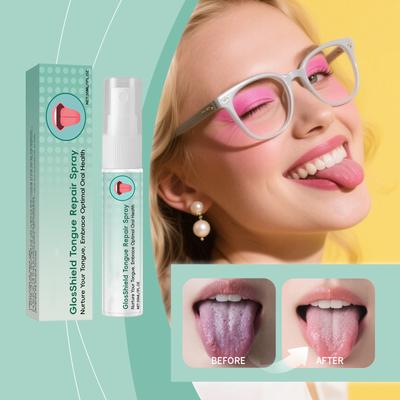 Tongue Soothing Spray Reduces Bad Breath. It Is Portable And Easy To Spray, Reducing Oral Discomfort. It Is Suitable For Daily Use,30ML