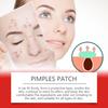 EELHOE Acne Patches with Salicylic Acid: Gentle Cleanse, Moisturize, and Soothe for Clear Skin. Portable Acne Care Solution.