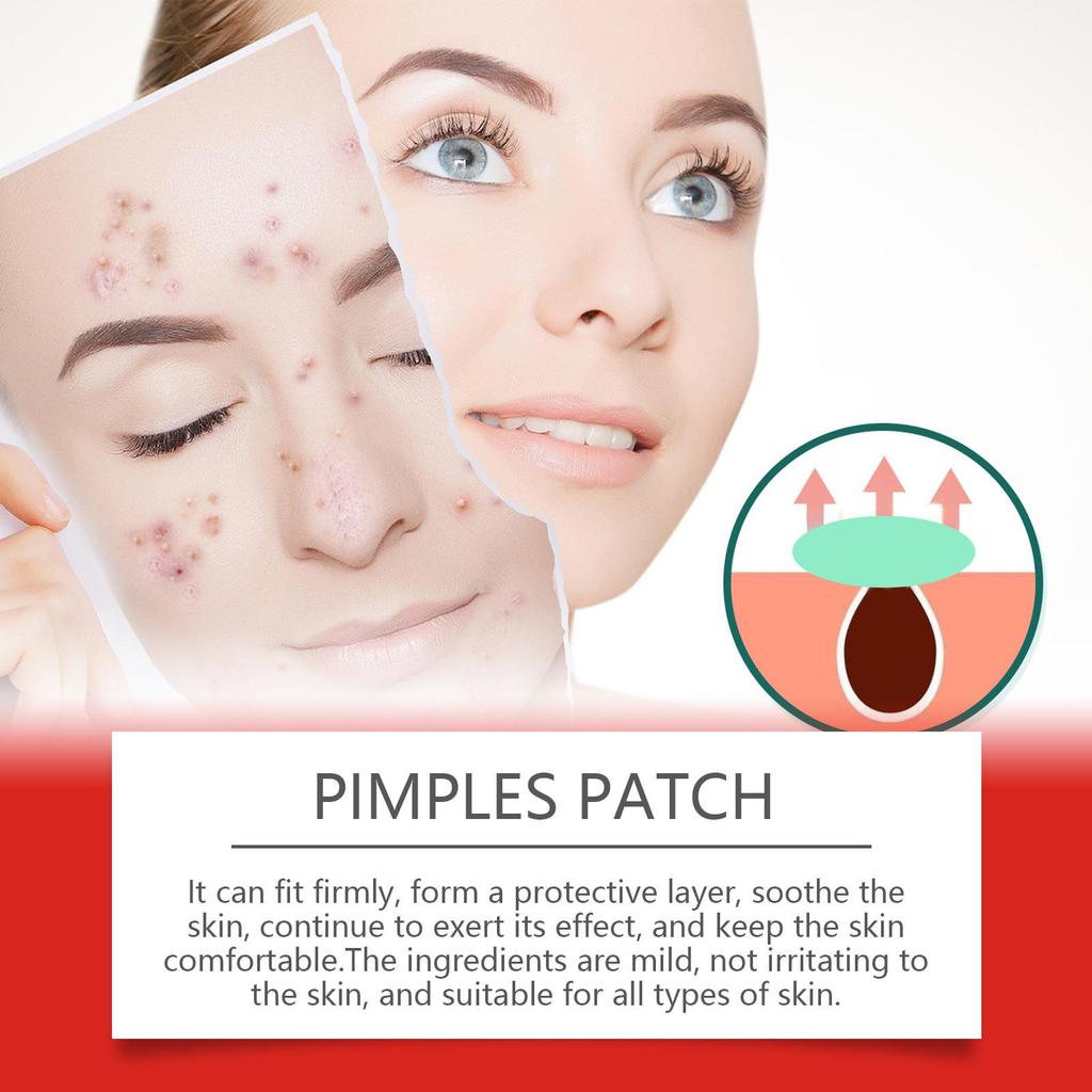 EELHOE Acne Patches with Salicylic Acid: Gentle Cleanse, Moisturize, and Soothe for Clear Skin. Portable Acne Care Solution.