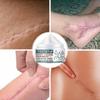 Whitening and Scar Removing Cream for Removing Scars and Acne, Anti-inflammatory and Repairing Damaged Skin, Even Skin Tone, Moisturizing Cream