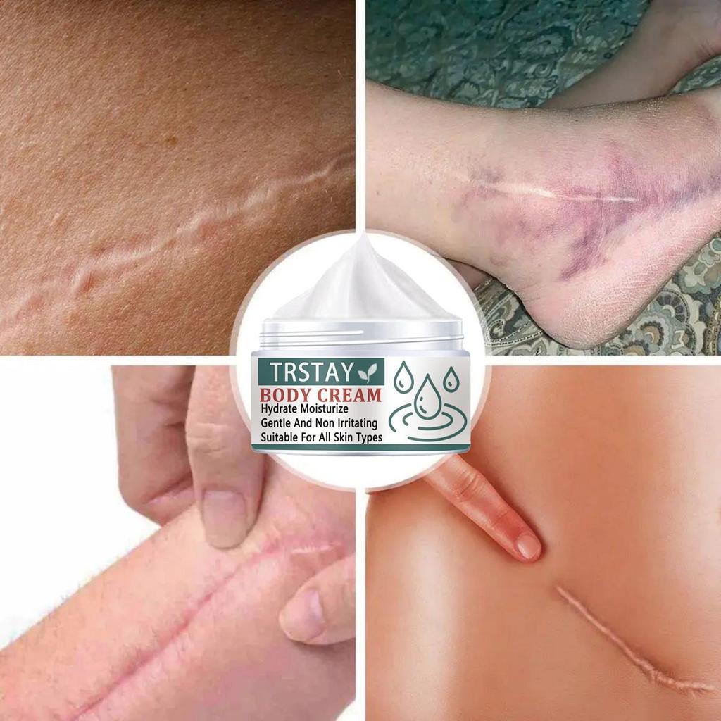 Whitening and Scar Removing Cream for Removing Scars and Acne, Anti-inflammatory and Repairing Damaged Skin, Even Skin Tone, Moisturizing Cream