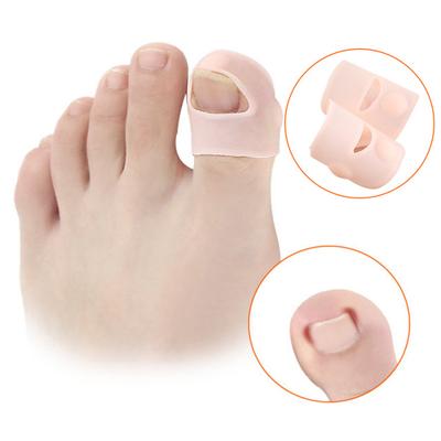 Tratamiento de uñas encarnadas para aliviar la inflamación, corrección de uñas de los pies para el hogar, útil, cómodo, 1 par