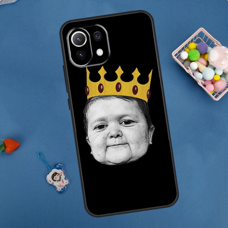 Funny Hasbulla Case For Xiaomi 14 13 15 Ultra 11T 12T 13T 14T Pro POCO X7 Pro X3 X5 F5 F6 M6 X6 Pro Cover