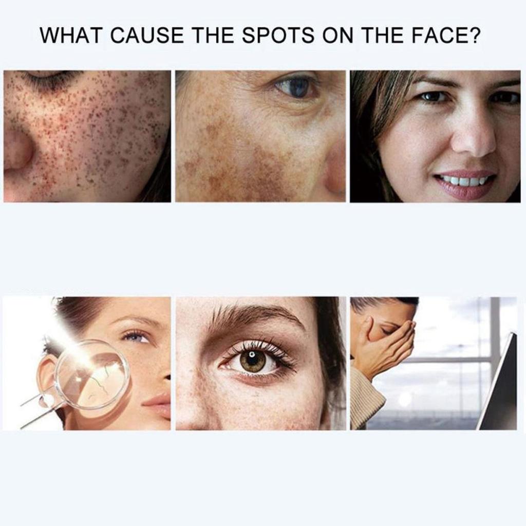 Facial whitening hyaluronic acid moisturizing essence, deep care, anti wrinkle and pore removal