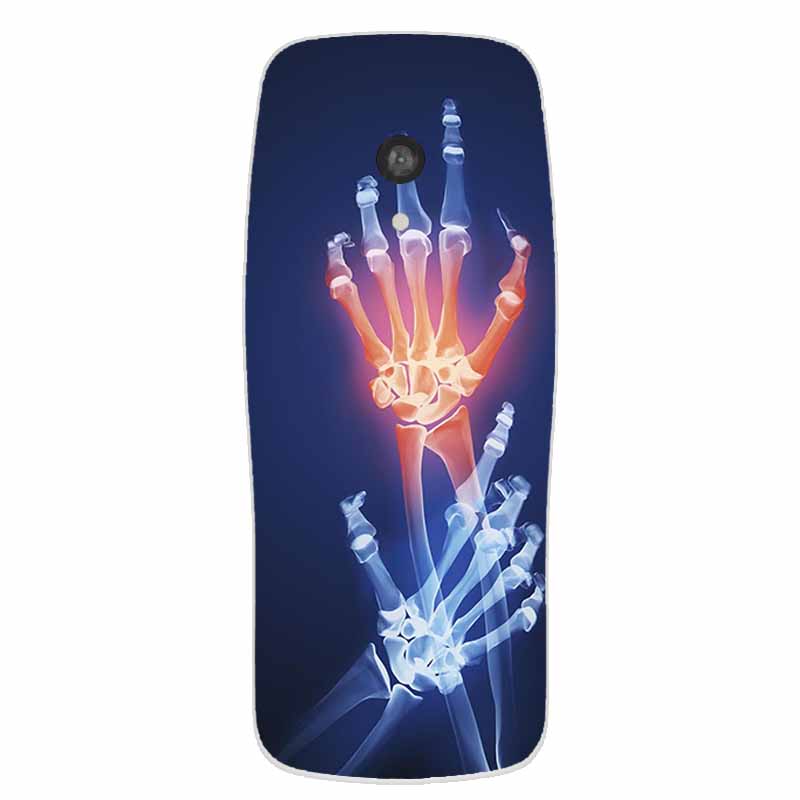 TPU Pouzdro Pro Nokia 3210 2024 Pouzdro 2.4" Coque Průhledné Silikonové Měkké Čiré Zadní Kryt Pro Nokia 3210 Pouzdro Na Telefon Funda Shell