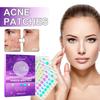 Jaysuing Acne Patches For Diminishing Facial Acne And Blemishes With Pore Care 180 Pcs