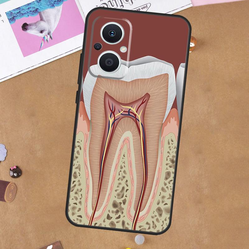 Human Tooth Anatomy Case For OPPO Reno 11 10 Pro 8 7 6 5 4 Lite 8T 5Z 4Z 11F OPPO Find X5 X6 Pro X2 Neo X3 Lite