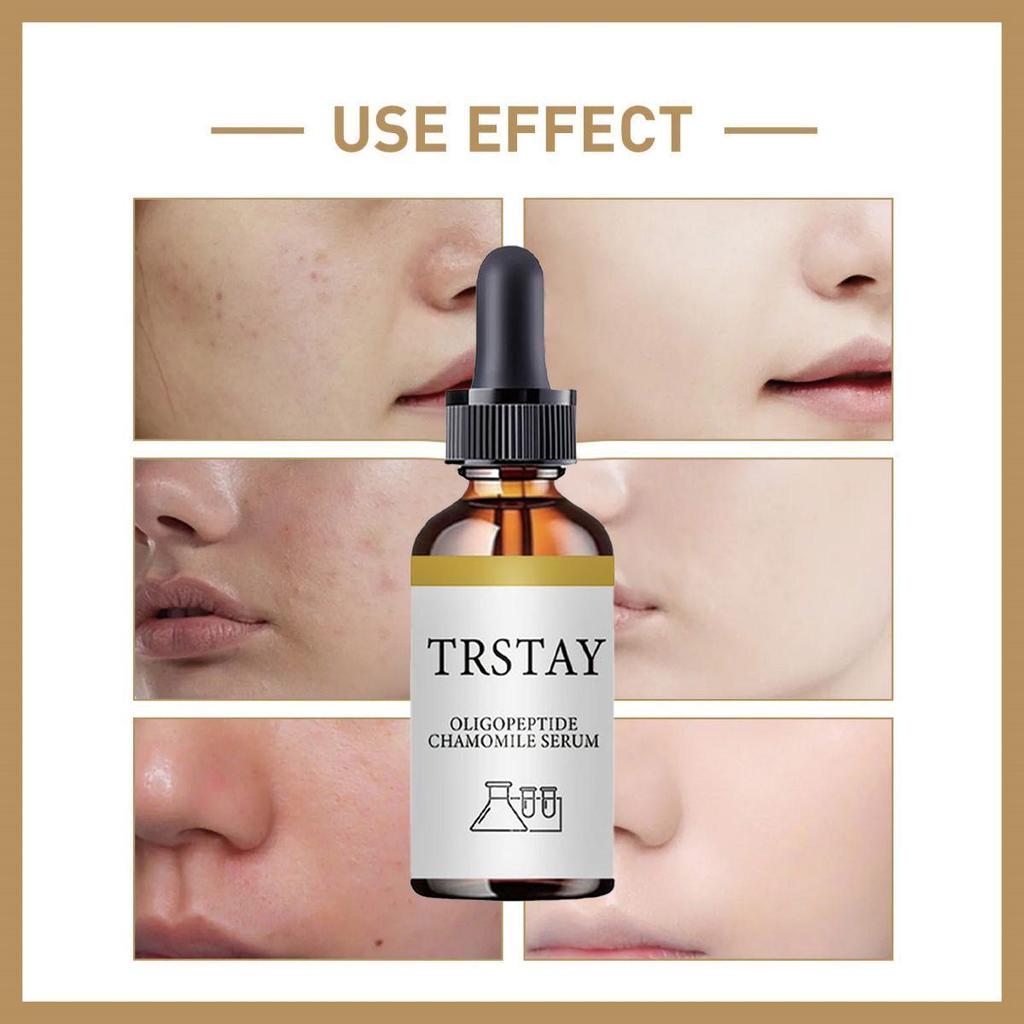 Ser de față Repararea pielii Anti-îmbătrânire Anti-rid Deep SkinCare Essence Cremă de albire a pielii pentru îndepărtarea cicatricilor acneei