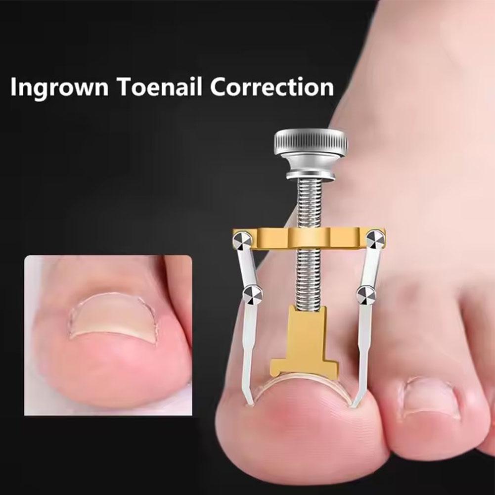 1-5pcs Ingrown Toenail Corrector Straightening Clip Pedicure Foot Nail Care Tools Pedicure Toenail Fixer Nail Pedicure Clipper