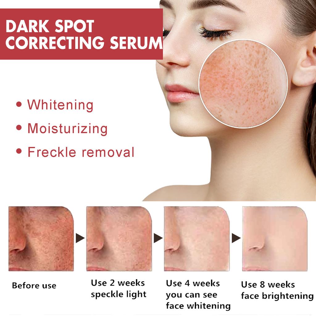 Hoygi Nawilżająca Rozjaśniająca Naprawcza Esencja Na Ciemne Plamy i Plamy Starcze