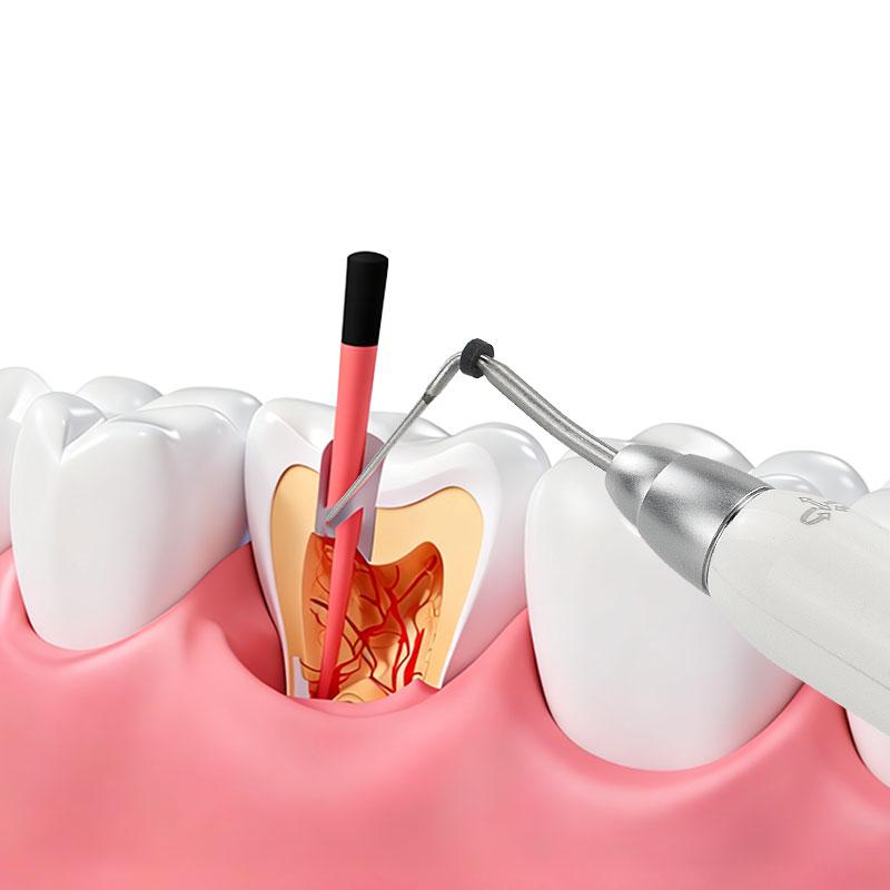 Dental Cordless Wireless Gutta Percha Obturation System Endo Heated Pen with 2 Tips