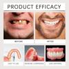 Denture Silicone Liners Soft Denture Silicone Kit Denture Kit Soft Denture Kit Teeth Upper And Lower Set Fake Tooth Oral Care