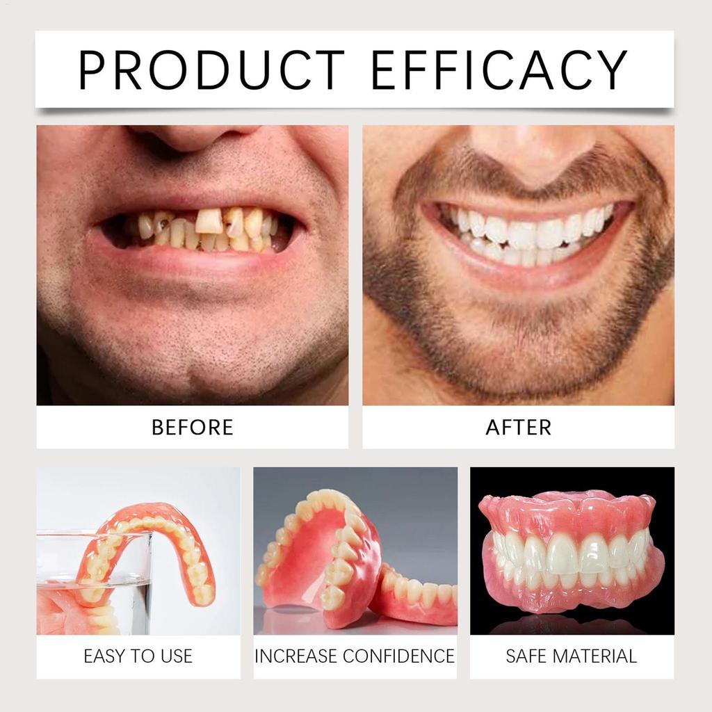 Denture Silicone Liners Soft Denture Silicone Kit Denture Kit Soft Denture Kit Teeth Upper And Lower Set Fake Tooth Oral Care