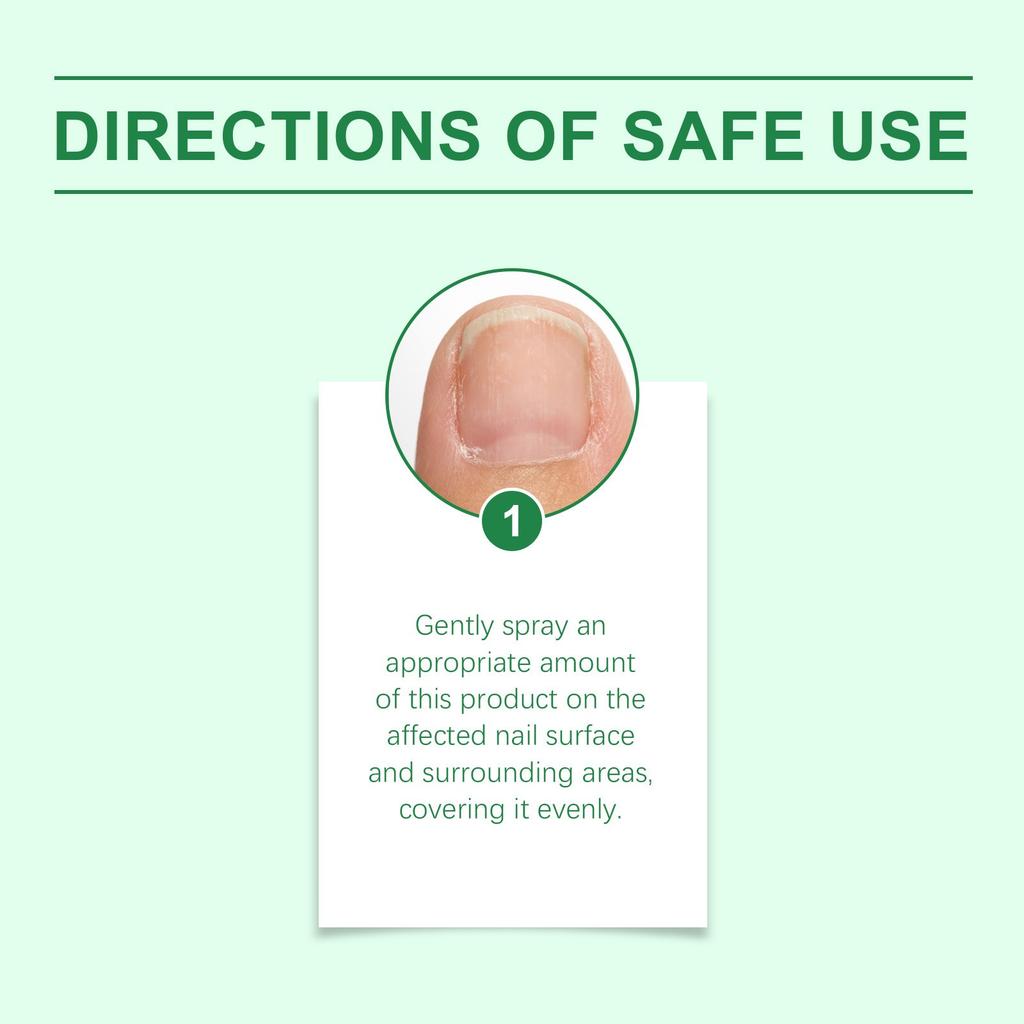 Nagelpflegeserum, Nagelpflegespray Mehrfach verwendbares nagelpflegendes Serum, Nagelstärkung, 30 ml