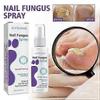 Medinail Fungus Spray,Toenail Fungus Treatment,Nail Fungus Treatment For Toenail
