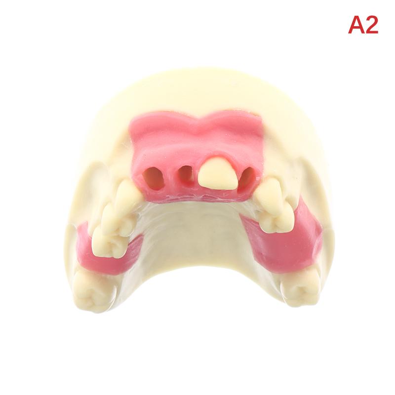 

1pc Maxillary Sinus Teeth Model Dental Implant Student Teaching Practice Model Upper Jaw Sinus Lift Implants Restoration Model