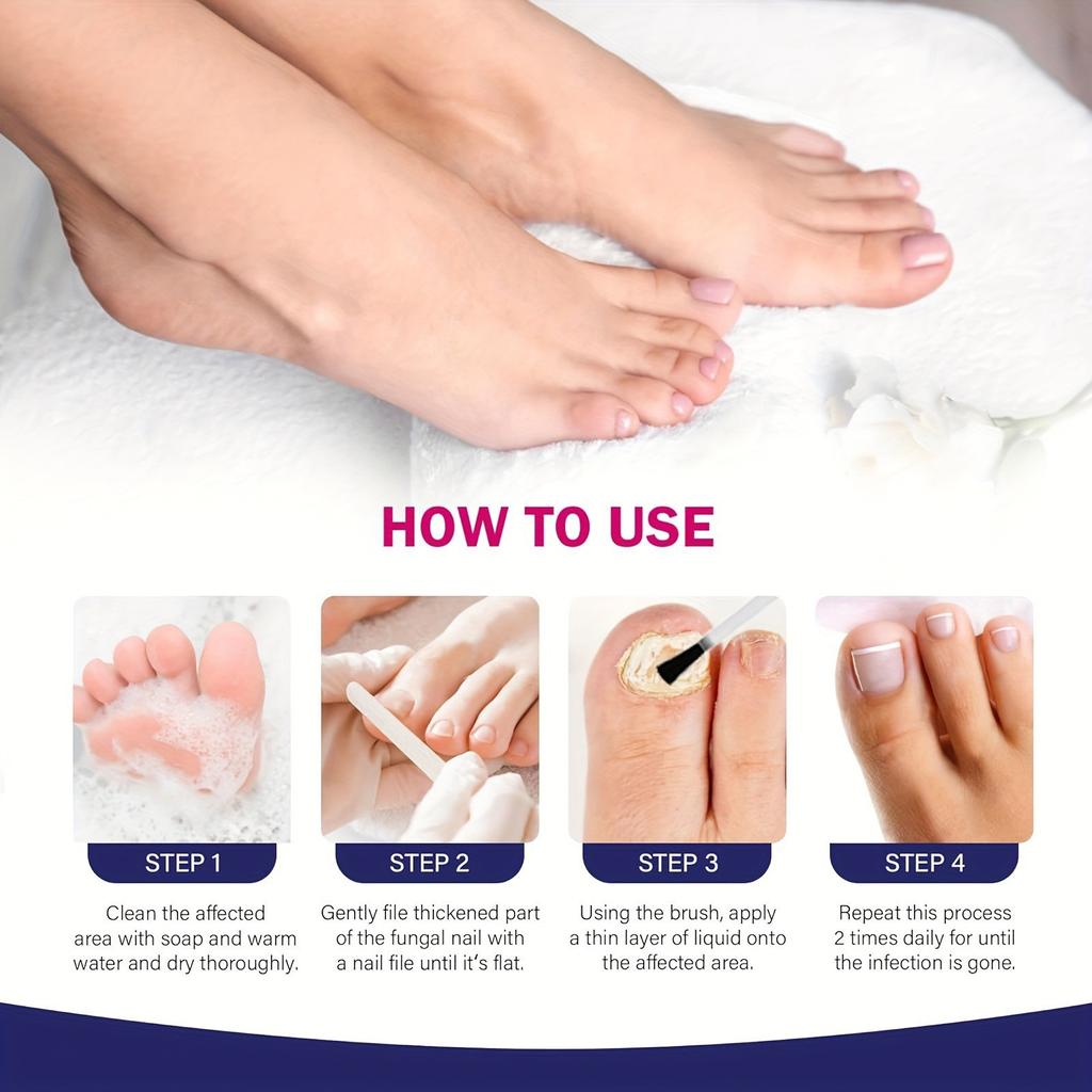 Night Nail Care Patches Improve Yellow And Thickened Nails, Reduce Onychomycosis And Soft Nails(72pcs/box)