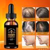 Anti Alopecia Oil Fast Growth Hair Loss Care Product Male and Female Hair Growth Essence Thickener