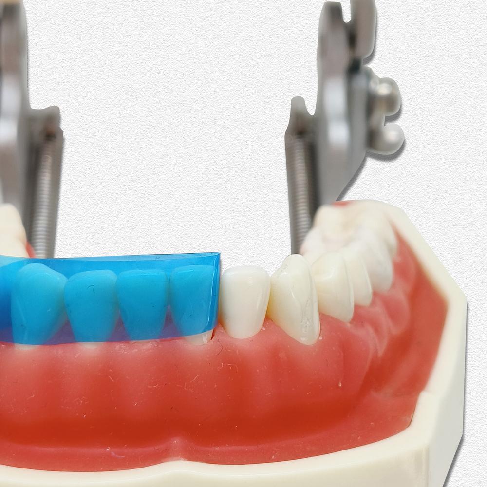 15pcs/50pcs Dental Contoured Anterior Matrix Blue Transparent Anterior Polyester Strip Thickness 0.05mm Dental Materials