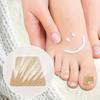 100 Pairs/50 Sheets Nail Repair Patches, Gentle and Breathable, Suitable for Toenails, Durable and Long-lasting