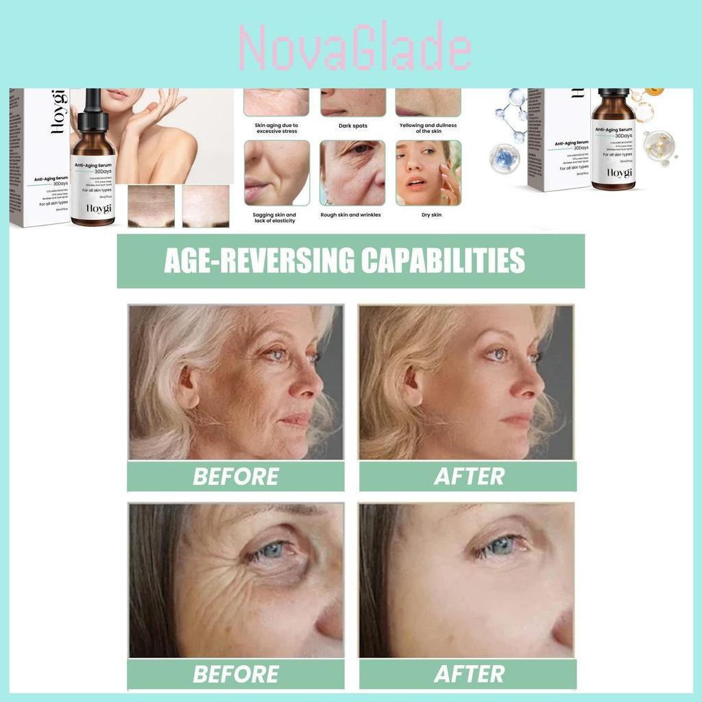 Hoygi Anti-aging Facial Serum Nourishing Hydrating Formula For Youthful Radiant Skin