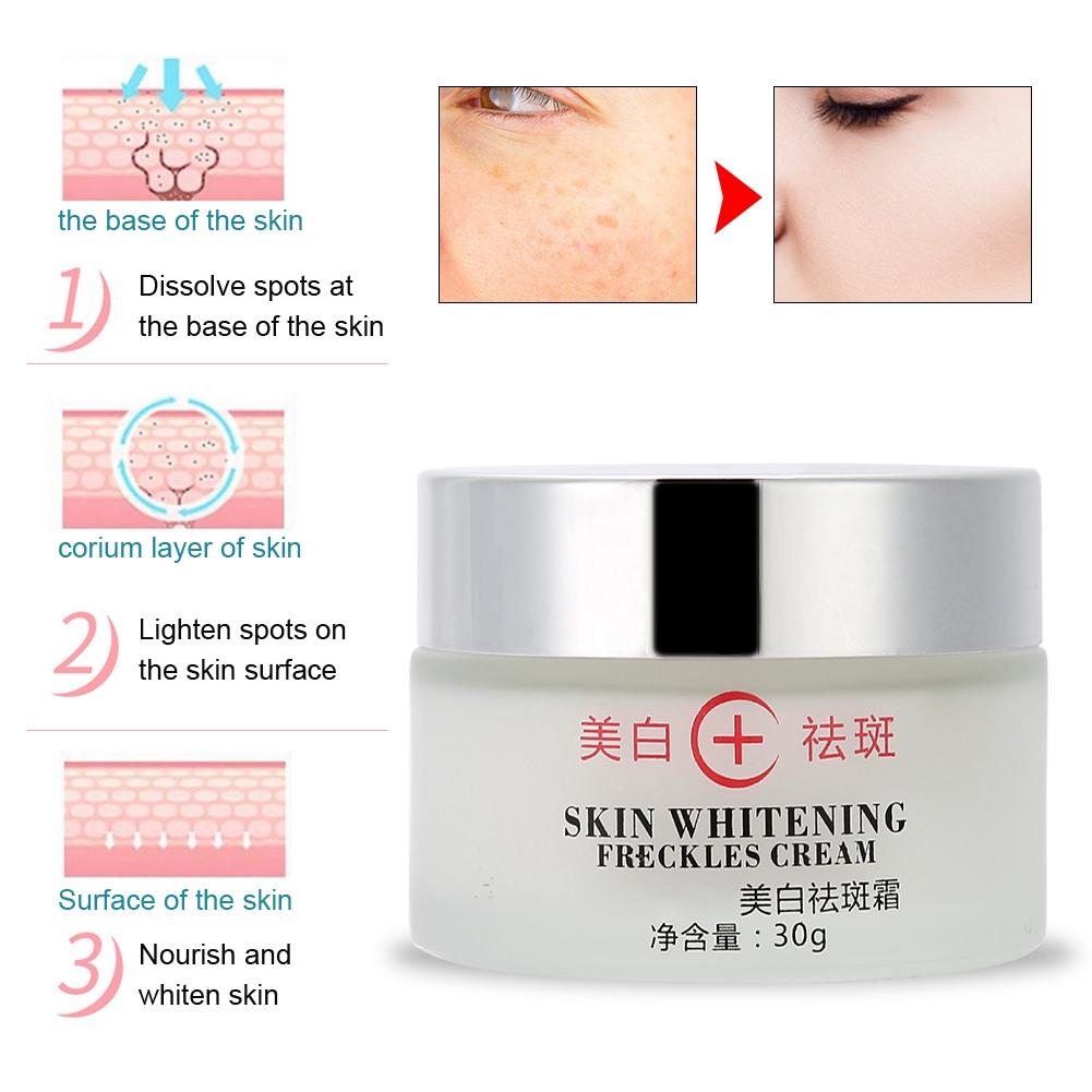 30g Anti Melasma Facial Whitening Brightening Cream Dark Spots Freckle Removal