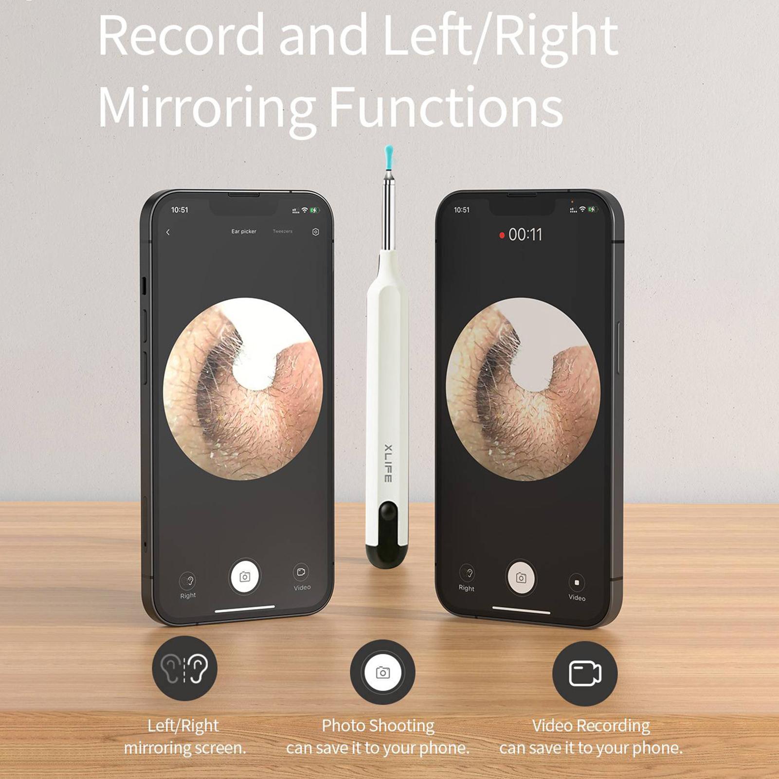 

Визуальный USB-перезаряжаемый очиститель для ушей, инструмент для удаления ушной серы, инструмент для чистки ложки для детей White