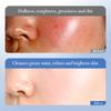 White Rice Nicotinamide Brightening and Whitening Luxury 6-piece Anti-wrinkle and Anti-aging Skin Care Set Facial Treatment