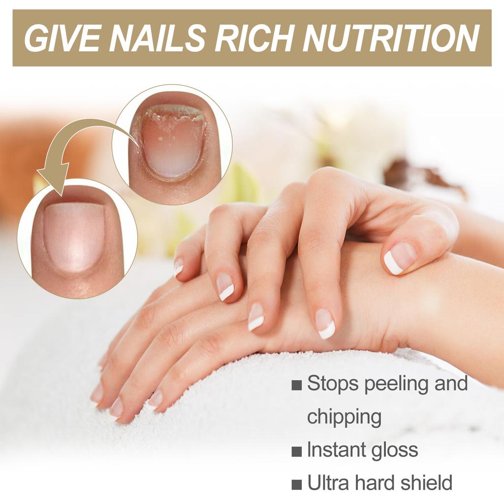 Nail Care Oil Hand & Foot Moisturizing Care Thickening Nail Gray Nail Ingrown Nail Shine Nail Oil