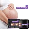 Scar Repair Cream Desalt Postoperative Scars, Smooth Skin, Repair Skin Wounds, Moisturize Skin Care Cream