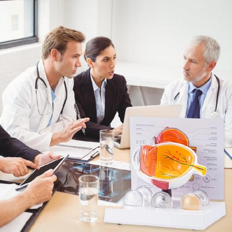 Anatomisch-pathologisches Augapfelmodell, Modell der menschlichen Augapfelanatomie, pathologisches Augapfelanatomiemodell als Lehrmittel