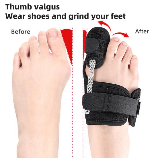 

Bunion Corrector for Men Women Orthopedic Bunion Splint Brace for Pain Relief Adjustable Bunion Correction Toe Straightener for Hallux Left Foot чёрный
