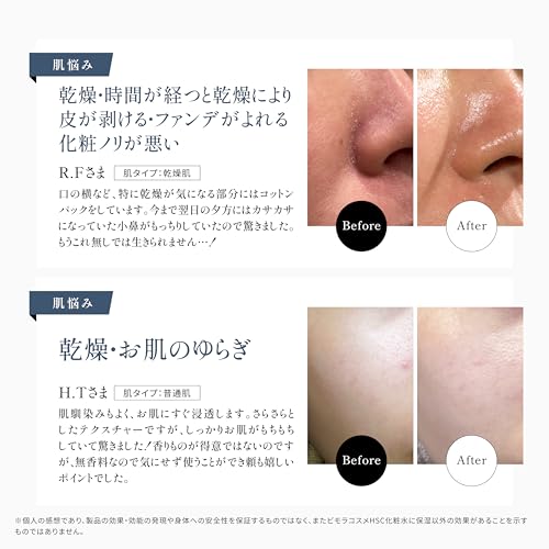 BimoRa Lotion and Emulsion Set, Human Stem Cell Skincare, Acne, Pore Care, Sensitive Skin, Dry Skin, Anti-Aging Care, Moisturizing, Sake Lees Extract,