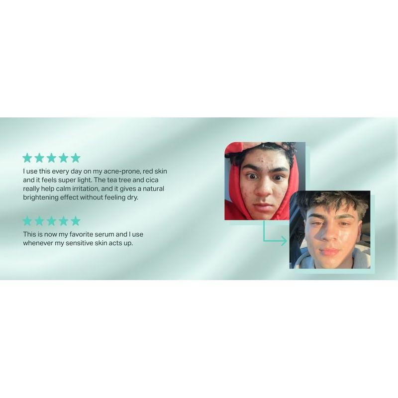 BRING GREEN - Zink Teca Unreinheiten Serum