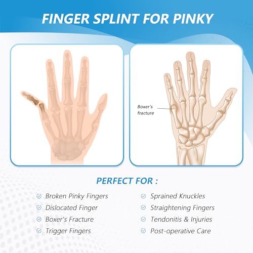 Removable aluminum strip support finger brace trigger tail finger splint tendon sheath little finger support protective splint