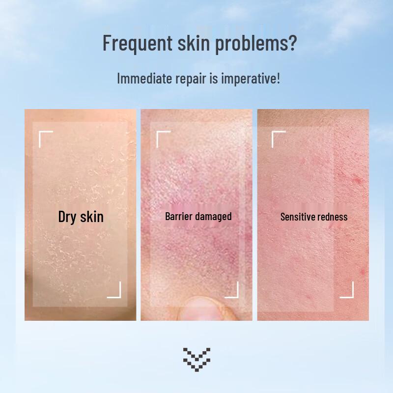 Naris B5 Panthenol Repairing Essence Sheet Mask (5-Pack)