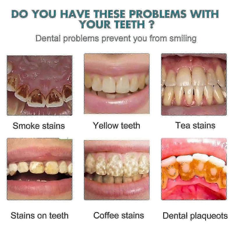 Teeth Whitening Gel, Tooth Polish, Instant Whitening Paint For Teeth, Safe And Effective For Sensitive Teeth -7340052400520