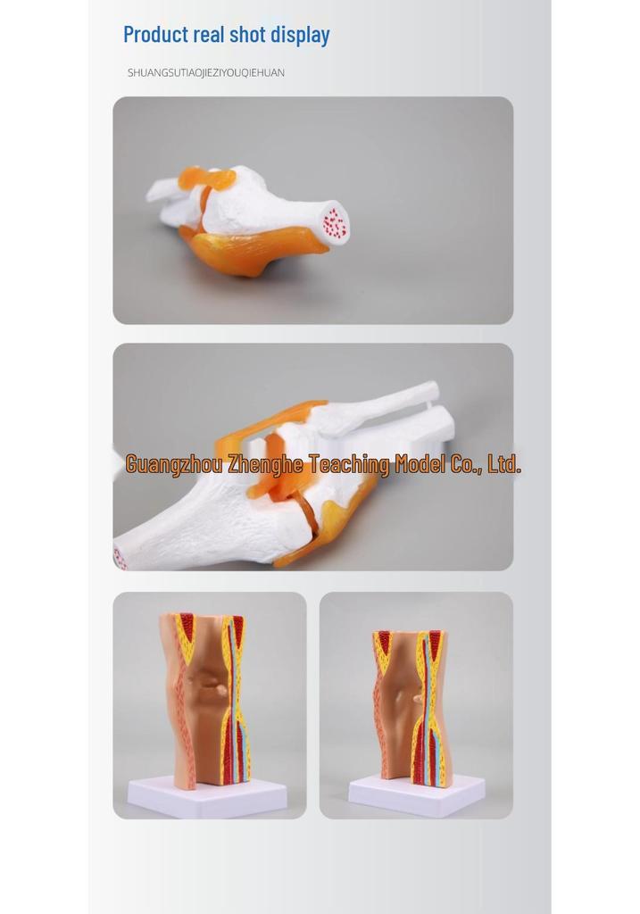 Removable Human Knee Joint Anatomy Model with Skin, Bones, Ligaments, and Meniscus for Medical Teaching