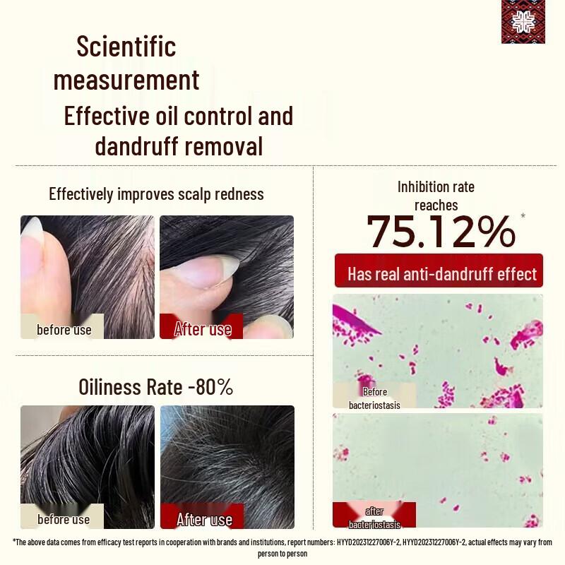 Changfa Xiaozhai Probiotic Anti-Dandruff Nourishing Shampoo
