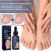 Cure Ingrown Toenail Treatment Infection Nail Care Oil Removals Paronychias