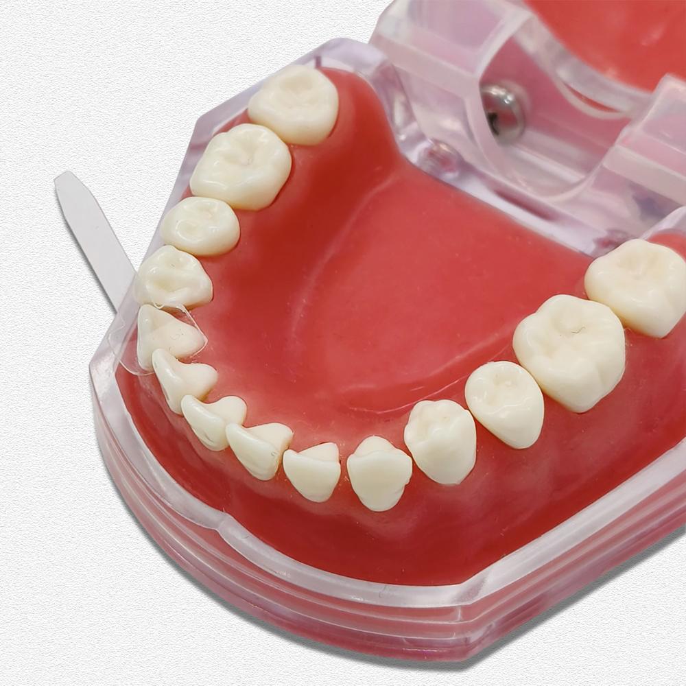 Dental Sectional Contoured Matrice Dental Strips Cervical Matrices Transparent Proximal Anterior Matrix Dental Strips Cervical Matrices