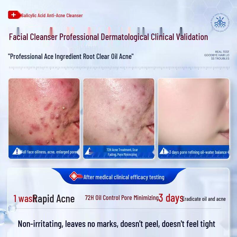BAILUHUI Salicylic Acid Acne Treatment Facial Cleanser