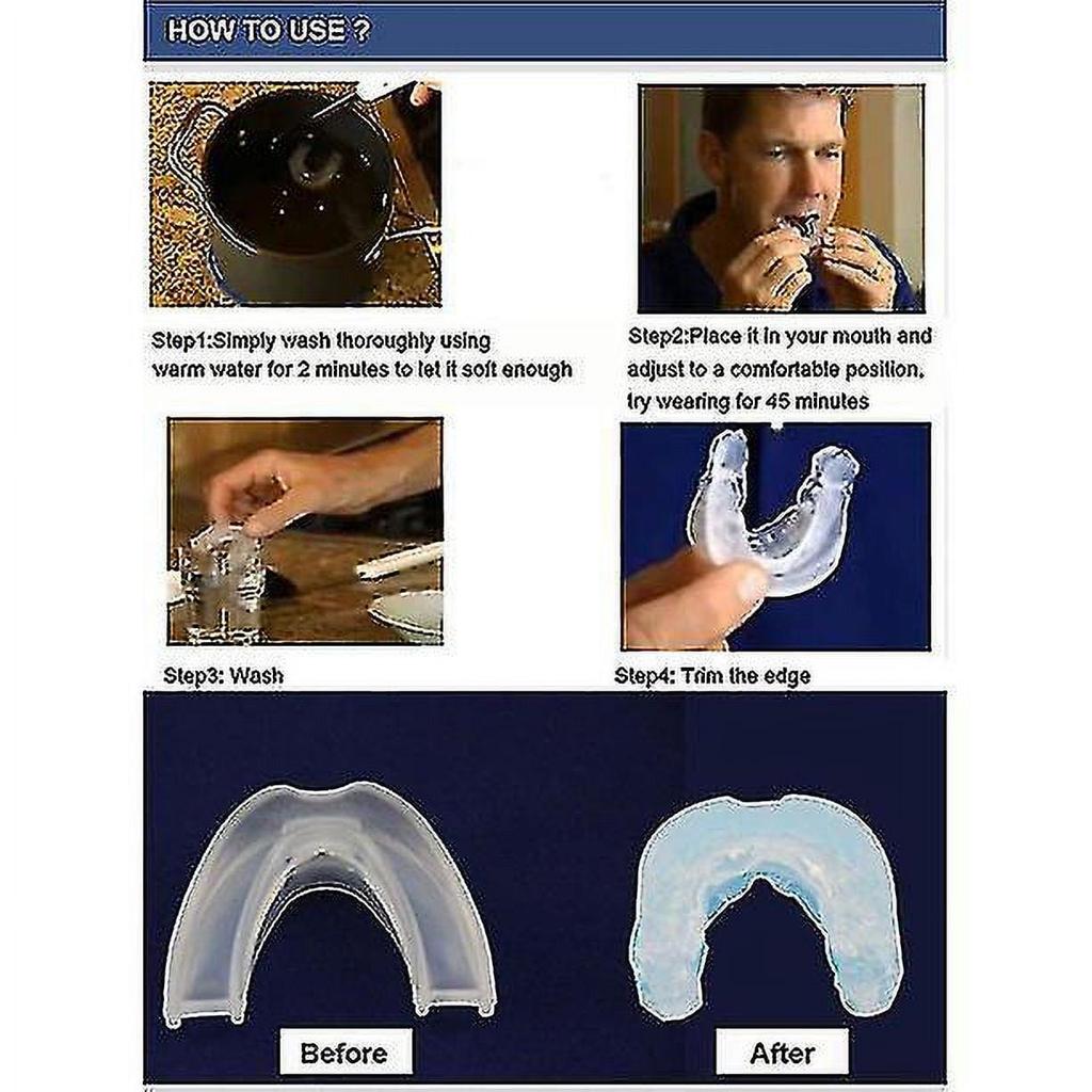 Anti Snoring Devices/ Snore Stopper/ Sleep Apnea/ Snoring Solution/ Stop Snoring/ Anti Snore Device/ Airing Sleep Apnea Device